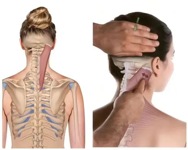 【合肥长淮中医医院】天气寒冷，这块肌肉容易僵硬劳损！