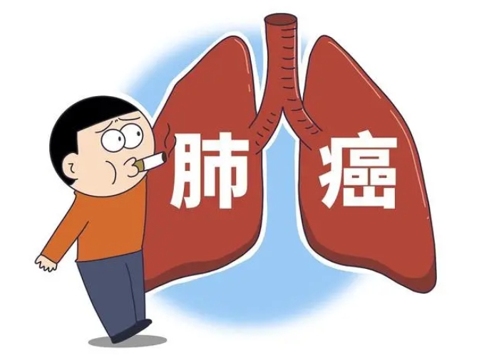 【合肥长淮中医医院】肺癌晚期已扩散病人能活多久？